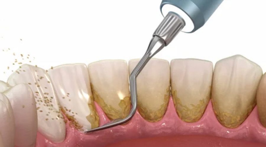 Happy person with braces